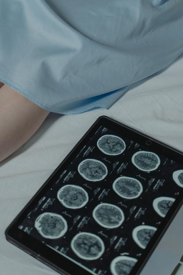 Alimentos funcionales para cuidar el cerebro y prevenir Alzheimer 3 enfermedades neurodegenerativas continuacion